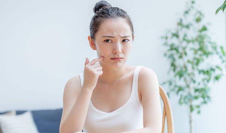 肌荒れが気になる女性