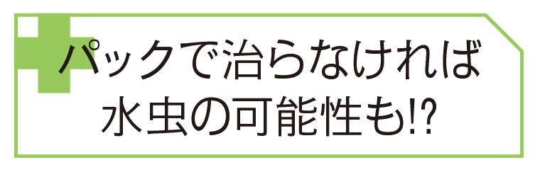 パックで治らなければ水虫の可能性も